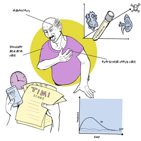 Core IM: 5 Pearls on Troponin – Clinical Correlations