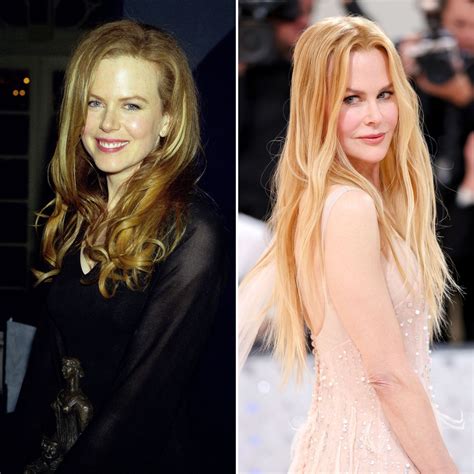 Did Nicole Kidman Have Plastic Surgery? See Transformation | Life & Style