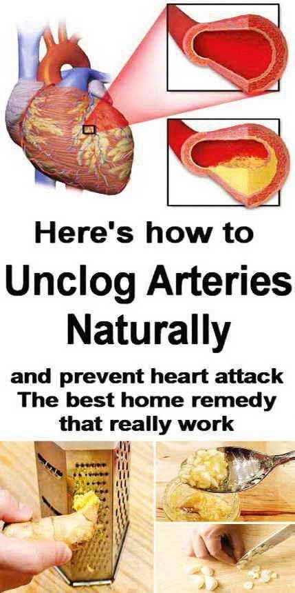 How to unclog arteries naturally? Here's your answer. #SciaticaNaturalRemedies #HealthyLife in ...