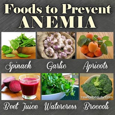 Health & nutrition tips: Foods to prevent anemia