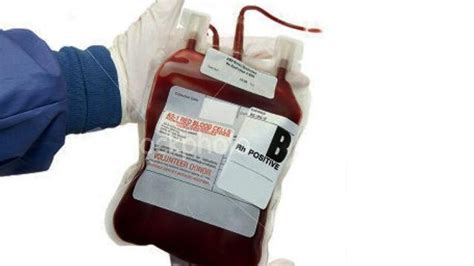 How Much Is A Pint Of Blood | Public Health