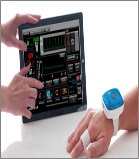 Wireless Patient Monitoring - Global Market Outlook (2016-2022)