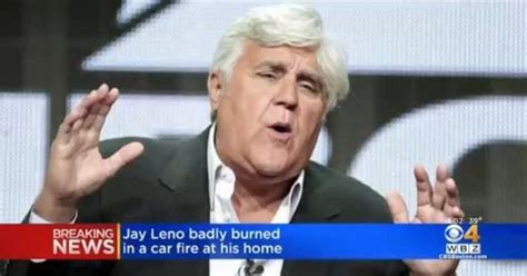 Jay Leno badly burned in car fire - CBS Boston