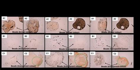 The light microscopy observations of (A) Ca-alginate beads without... | Download Scientific Diagram