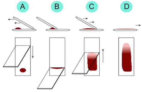 Lecture Notes in Medical Technology: Lecture #13: Morphological Examination of Blood Films