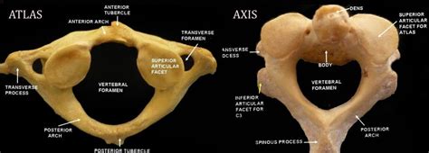 Vertebrae Different Types: Cervical, Thoracic, Lumbar, Sacrococcygeal