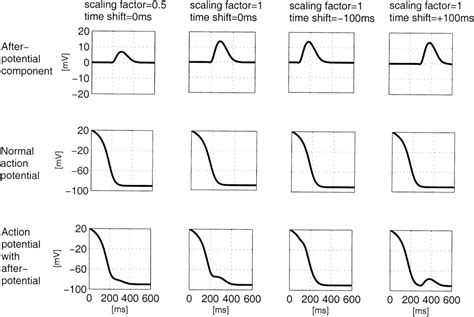 Figure 1 from Origin on the electrocardiogram of U-waves and abnormal U ...