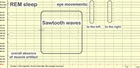 rapid eye movement (REM) sleep