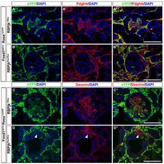 Formation of the mesangium requires the canonical Notch signaling ...