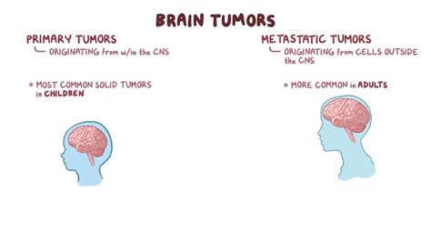 Brain Tumor Symptoms In Women