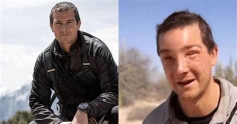 Bear Grylls Allergic To Bees:Wildlife Expert Bear Grylls Saved By ...