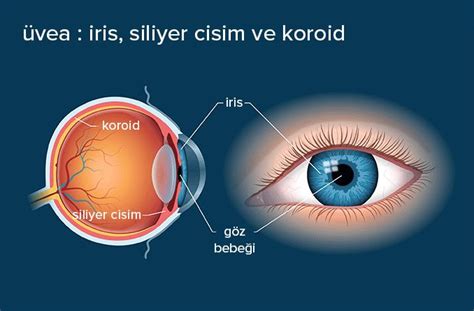 Gözün irisi ve üveası