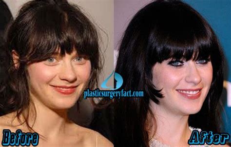 Zooey Deschanel Nose Job