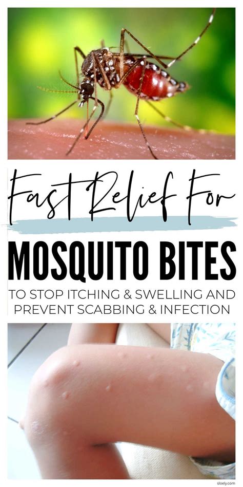 5 natural ways to prevent mosquito bites – Artofit