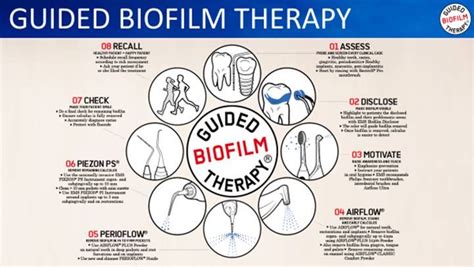 What is Guided Biofilm Therapy? l London Hygienist