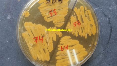 Candida krusei: Introduction, Morphology, Pathogenicity, Lab