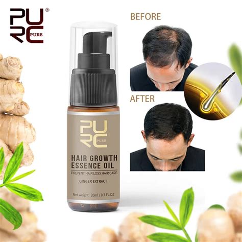 Aliexpress.com : Buy PURC 20ml Ginger Extract Hair Growth Essential Oil ...