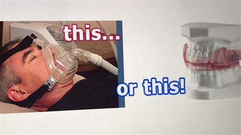 Alternatives to the Sleep Apnea CPAP Machine Treatment - YouTube