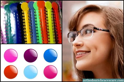 Best Braces Colors For Girls: How to choose - Orthodontic Braces Care