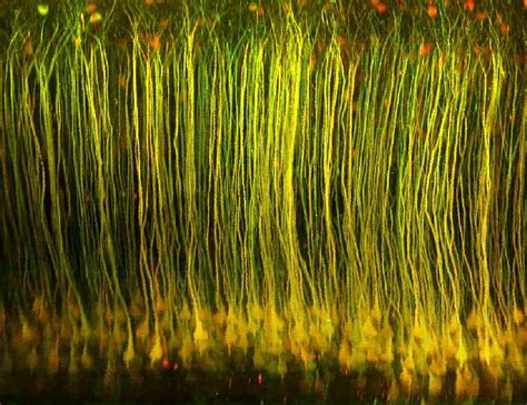 Sounding out the brain: acoustic signals focus light on neurons