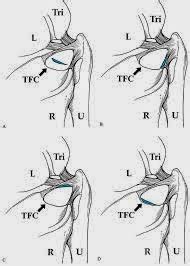 Medical Treatment Pictures-for Better Understanding: Arthroscopic Shoulder Synovectomy Surgery ...