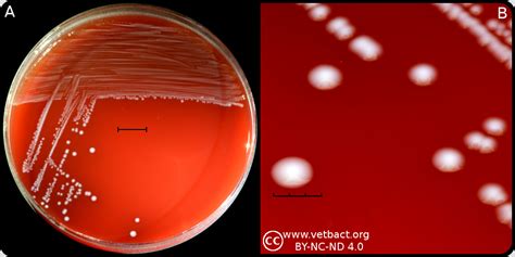 Enterococcus faecalis
