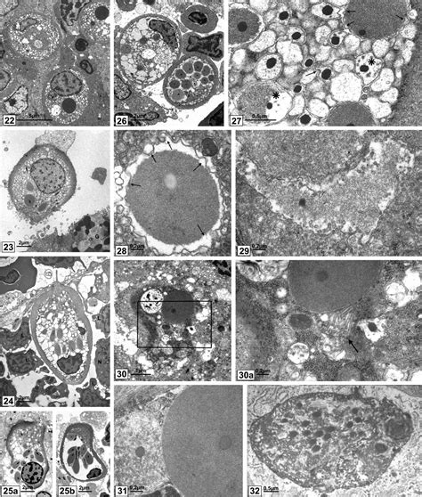 Membrane Transformations in Degenerating Rodlet Cells in Fishes of Two Teleostean Families ...