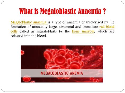 PPT - Megaloblastic Anaemia: Symptoms, causes, diagnosis, treatment and ...