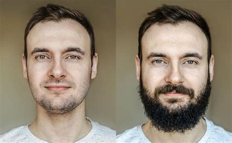 Derma Roller for Beard Growth: How Long Does It Take to See Results ...