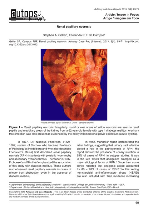 (PDF) Renal papillary necrosis