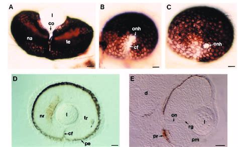 The choroid fissure fails to close in noi − embryos. (A-C) are whole ...