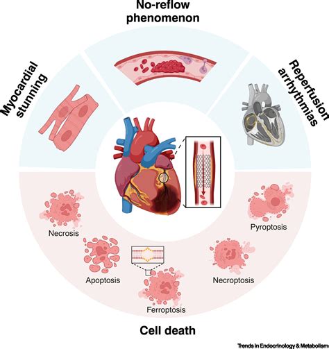 Regulated cell death in myocardial ischemia–reperfusion injury: Trends in Endocrinology & Metabolism