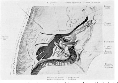 Figure 1 from II. Normal and Pathological Anatomy of the Petrous ...