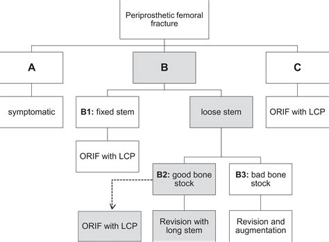 Treatment of Periprosthetic Femoral Fractures Vancouver Type B2: Revision Arthroplasty Versus ...