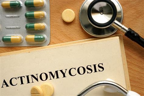 Actinomycosis: Causes, types, symptoms, and diagnosis