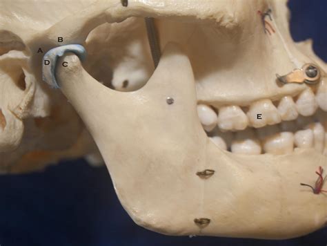 The TMJ (Temporomandibular Joint) - II.4 – The Center for Dental Education