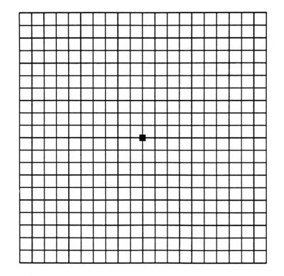 Macular Degeneration Grid: Check Your Vision with an Amsler Grid