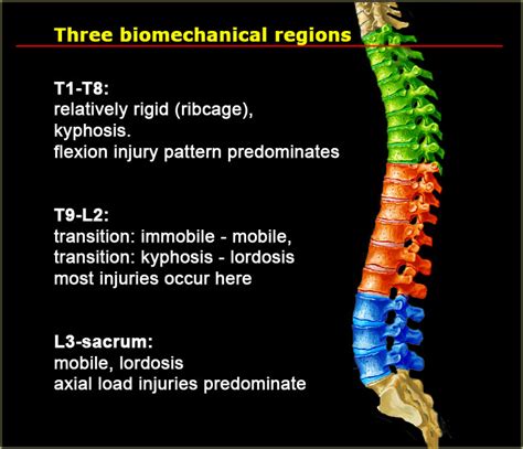 The Radiology Assistant : Spine ... | Soft tissue injury, Bone injuries, Thoracic region