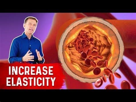 A recent study has shown a correlation between arterial stiffness and vitamin D levels. Learn ...