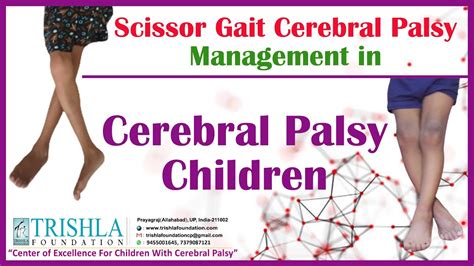 Scissor gait cerebral palsy management in cerebral palsy children - YouTube
