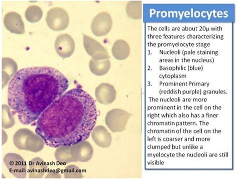 Myelocyte Vs Promyelocyte - - Yahoo Image Search Results Laboratory Humor, Medical Laboratory ...