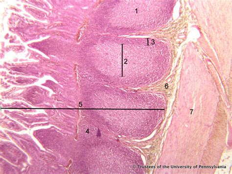 Histology slides - Lymphatic Tissue Flashcards | Quizlet