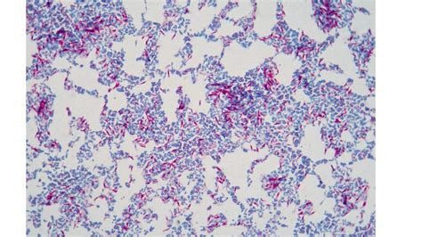 ACID-FAST STAIN – Laboratory Exercises in Microbiology