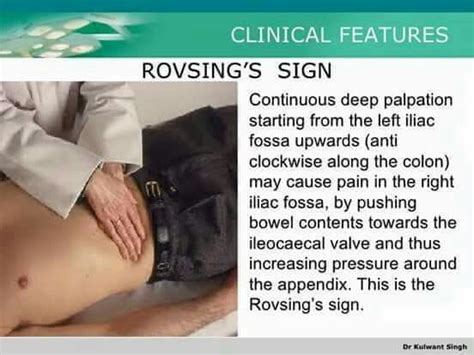 Rovsing's Sign | Rovsing's sign, Nursing cheat, Medical terminology