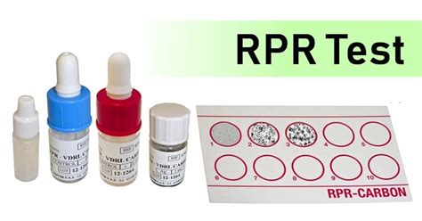 Rapid Plasma Reagin (RPR) Test