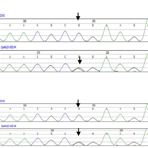 (a) The mutation in the RYR1 gene was confirmed by sequencing ...