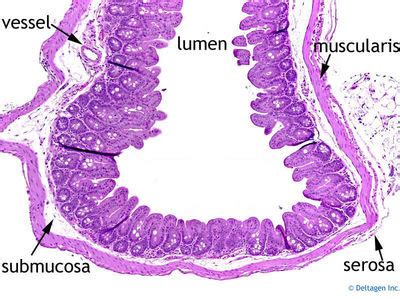 Large Intestine Histology - Cecum (labels) - histology slide