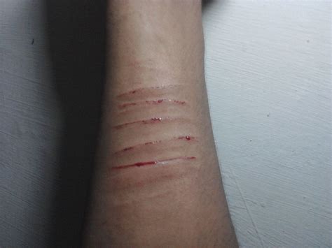 Hand Cuts | After Loving a wrong Person | Haris Khan Musazai | Flickr