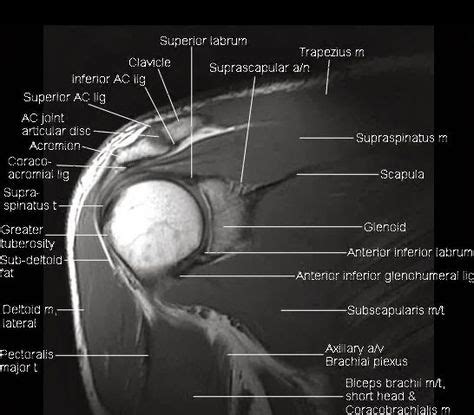 mri anatomy shoulder - Google Search | Radiología, Ortopedia y traumatologia, Anatomía humana