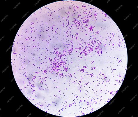 Premium Photo | Microscopic view of gram stain showing Escherichia coli ...